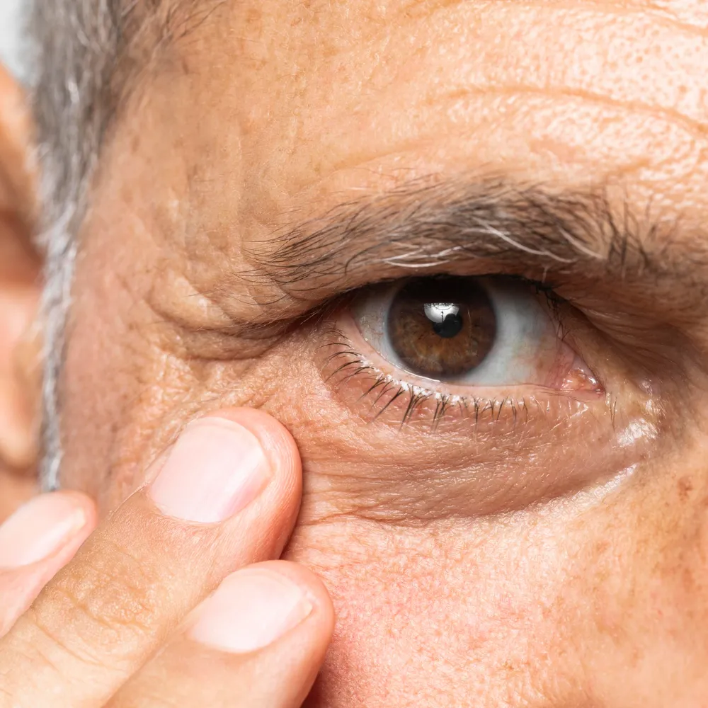Cataract Treatment