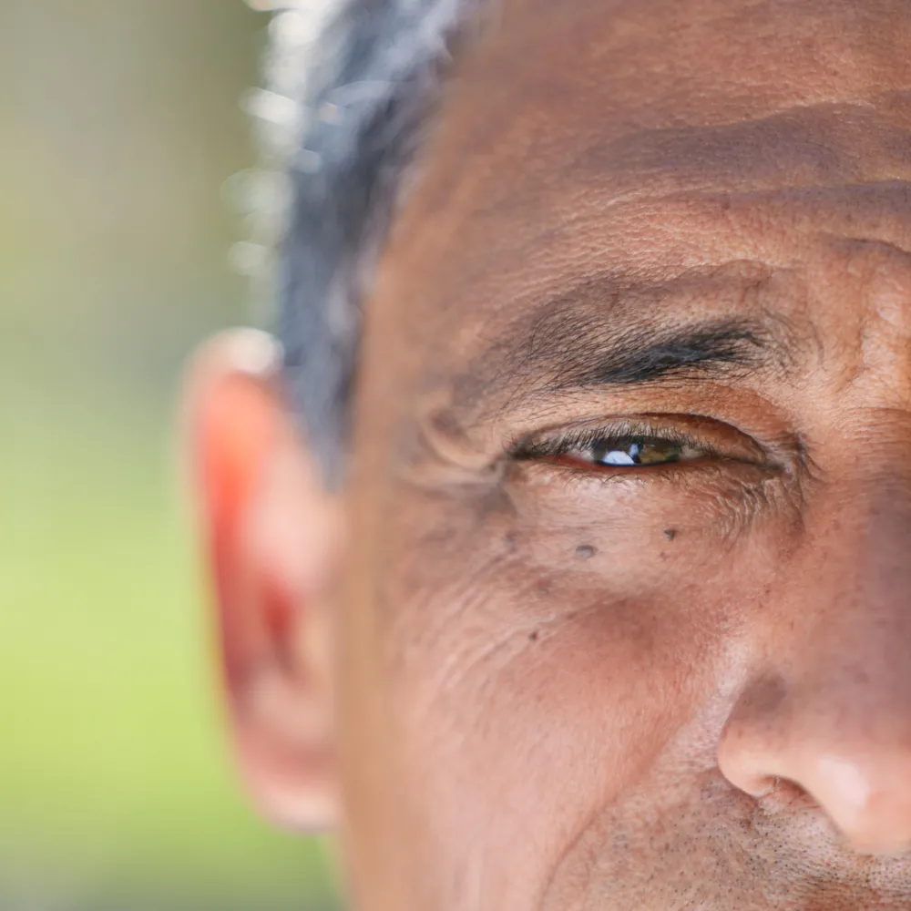 Macular Degeneration